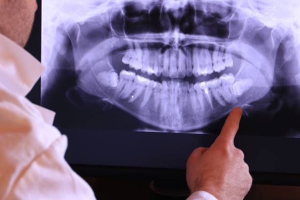 Best Emergency Dental Surgery in El Reno, OK