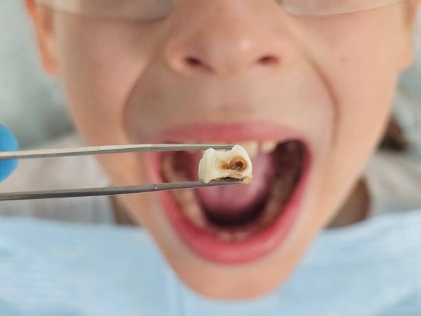 Best Emergency Treatment for Toothache in El Reno, OK